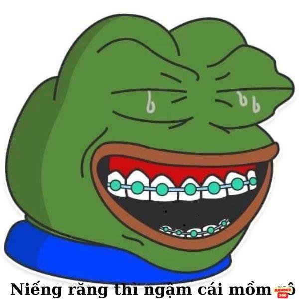 meme ếch xanh niềng răng